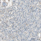 Immunohistochemical staining of human pancreas shows no positivity in exocrine glandular cells as expected.