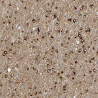 Immunohistochemical staining of human cerebral cortex shows strong cytoplasmic positivity in glial cells.