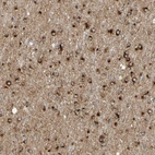 Immunohistochemical staining of human cerebral cortex shows strong cytoplasmic positivity in glial cells.