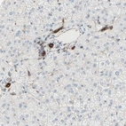 Immunohistochemical staining of human liver shows strong cytoplasmic positivity in bile duct cells.