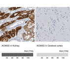 Anti-ACMSD Antibody