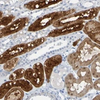 Immunohistochemical staining of human kidney shows moderate to strong cytoplasmic positivity in cells in tubules.