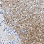 Anti-ACMSD Antibody