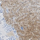 Immunohistochemical staining of human liver shows weak to moderate cytoplasmic positivity in hepatocytes.