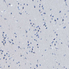 Immunohistochemical staining of human cerebral cortex shows no positivity in neurons as expected.