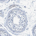 Immunohistochemical staining of human testis shows no positivity in cells in seminiferous ducts as expected.
