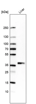 Western blot analysis in human liver tissue.