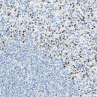 Anti-CYSLTR1 Antibody