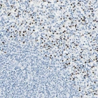 Anti-CYSLTR1 Antibody