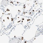 Anti-CYSLTR1 Antibody