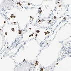 Immunohistochemical staining of human lung shows strong cytoplasmic/membranous positivity in macrophages.