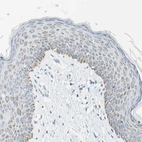 Immunohistochemical staining of human skin shows weak cytoplasmic/membranous positivity in squamous epithelial cells.