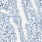 Immunohistochemical staining of human endometrium shows no positivity in glandular cells, as expected.
