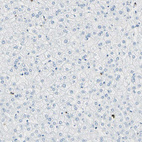 Immunohistochemical staining of human liver shows no positivity in hepatocytes, as expected.