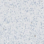 Immunohistochemical staining of human liver shows no positivity in hepatocytes, as expected.
