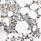 Immunohistochemical staining of human bone marrow shows strong nuclear positivity in hematopoietic cells.