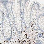 Immunohistochemical staining of human rectum shows strong nuclear positivity in lymphoid cells.