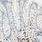 Immunohistochemical staining of human rectum shows strong nuclear positivity in lymphoid cells.