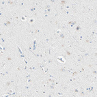 Immunohistochemical staining of human cerebral cortex shows low positivity in neurons as expected.