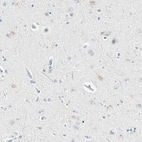 Immunohistochemical staining of human cerebral cortex shows low positivity in neurons as expected.