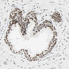 Immunohistochemical staining of human prostate shows moderate to strong nuclear positivity.