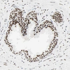 Immunohistochemical staining of human prostate shows moderate to strong nuclear positivity.