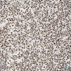 Immunohistochemical staining of human tonsil shows moderate to strong nuclear positivity in germinal center cells.