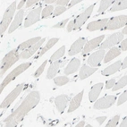 Immunohistochemical staining of human skeletal muscle shows weak nuclear positivity in myocytes.