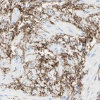 Immunohistochemical staining of human smooth muscle shows strong membranous positivity in smooth muscle cells.
