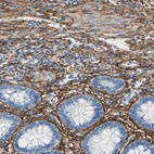 Immunohistochemical staining of human rectum shows strong membranous positivity in cells in lamina propria.
