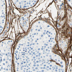 Immunohistochemical staining of human testis shows strong membranous positivity in cells in lamina propria.