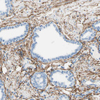 Immunohistochemical staining of human prostate shows strong membranous positivity in smooth muscle cells.