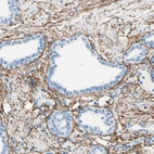 Immunohistochemical staining of human prostate shows strong membranous positivity in smooth muscle cells.