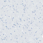 Immunohistochemical staining of human cerebral cortex shows no positivity in neurons as expected.