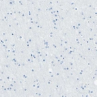 Immunohistochemical staining of human cerebral cortex shows no positivity in neurons as expected.