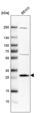 Western blot analysis in human cell line BEWO.