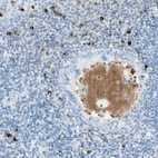 Immunohistochemical staining of human plasma shows moderate positivity.