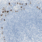 Anti-IL6ST Antibody