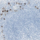 Immunohistochemical staining of human tonsil shows strong cytoplasmic positivity in non - germinal center cells.