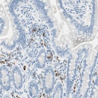Immunohistochemical staining of human small intestine shows strong cytoplasmic positivity in lymphoid cells.
