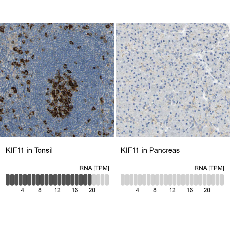 Anti-KIF11 Antibody
