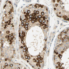 Immunohistochemical staining of human testis shows strong cytoplasmic positivity in cells in seminiferous ducts.