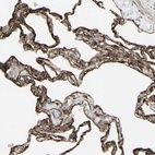 Anti-DTX3L Antibody