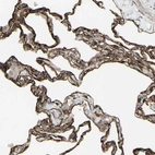 Anti-DTX3L Antibody