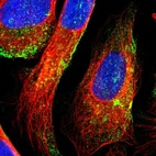 Immunofluorescent staining of human cell line U-2 OS shows localization to cytosol.