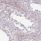 Immunohistochemical staining of human testis shows weak cytoplasmic positivity in Leydig cells.