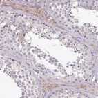 Immunohistochemical staining of human testis shows weak cytoplasmic positivity in Leydig cells.