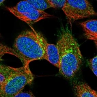 Immunofluorescent staining of human cell line SH-SY5Y shows localization to plasma membrane & vesicles.