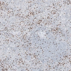 Immunohistochemical staining of human spleen shows strong cytoplasmic positivity in cells in red pulp.