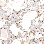Immunohistochemical staining of human lung shows strong cytoplasmic positivity in granulocytes.